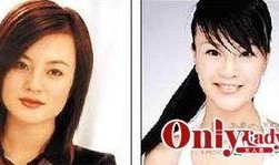 综艺爆料明星整容视频